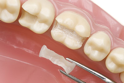 Norwalk Dental Center | Dentures, Teeth Whitening and Periodontal Treatment