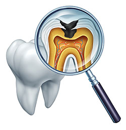 Norwalk Dental Center | Dental Bridges, Laser Dentistry and TMJ Disorders