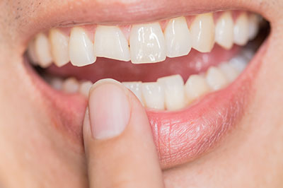 Norwalk Dental Center | Laser Dentistry, Oral Cancer Screening and Dental Cleanings