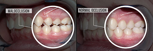 Norwalk Dental Center | TMJ Disorders, Dentures and Laser Dentistry