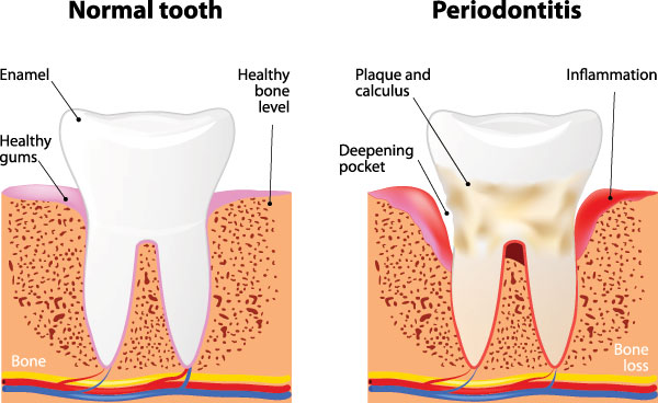Norwalk Dental Center | Pediatric Dentistry, Digital Radiography and Periodontal Treatment